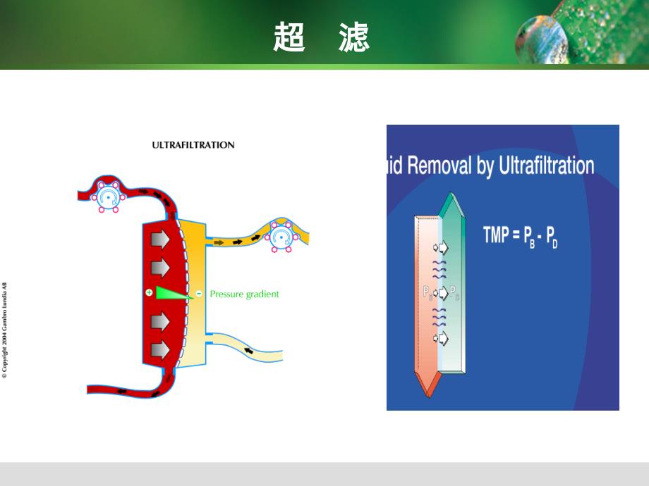 CRRT规范化治疗_第4页