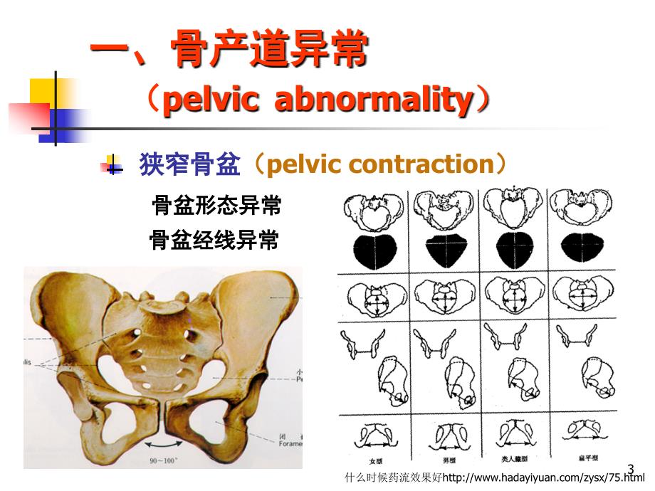 产道异常的分类和临床表现PPT演示课件_第3页