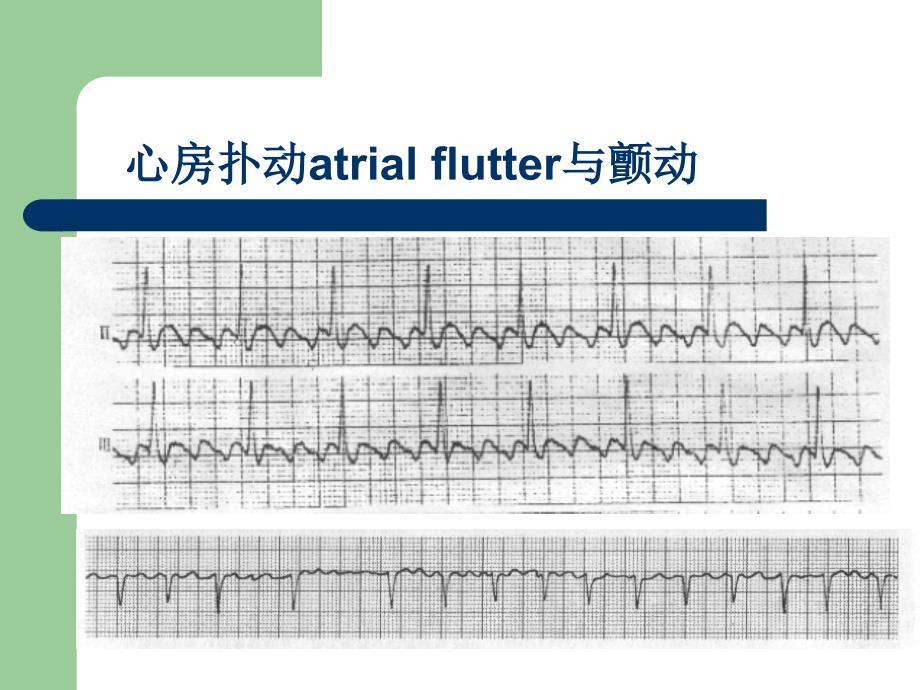 心电图基础知识_第3页