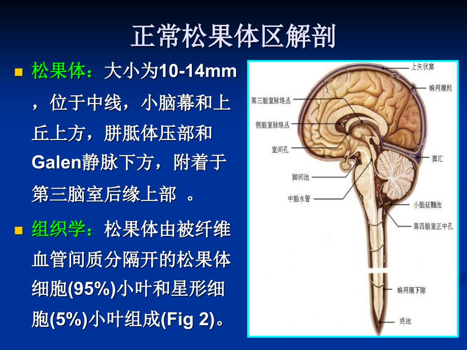 松果体区病变影像诊断PPT课件_第2页