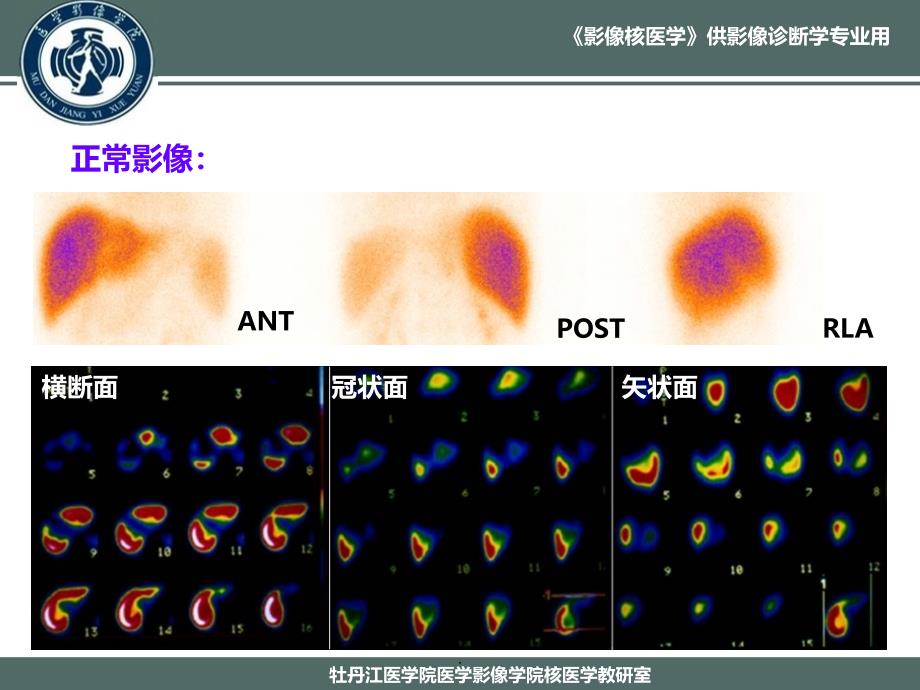 消化系统的案例ppt课件_第4页