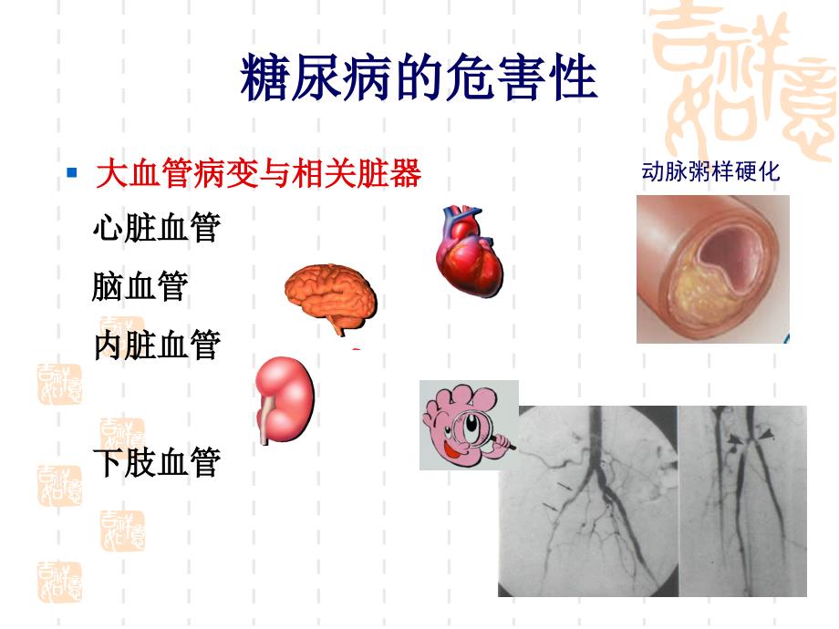 糖尿病综合围手术_第2页