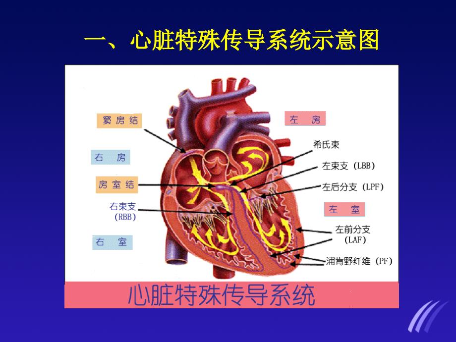 临床常见心电图的判读ppt件_第3页