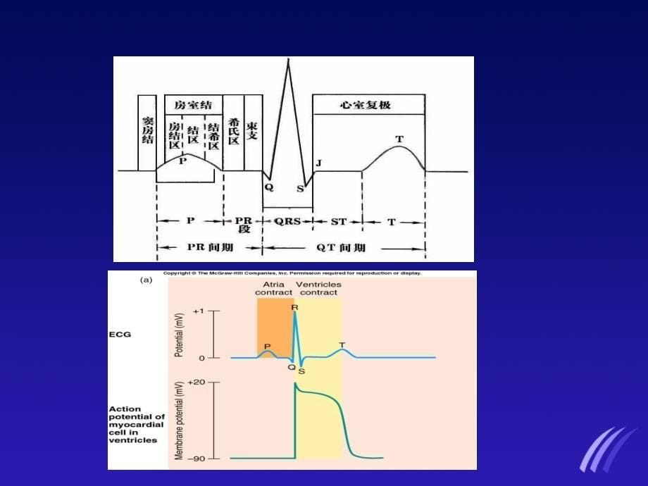 临床常见心电图的判读ppt件_第5页