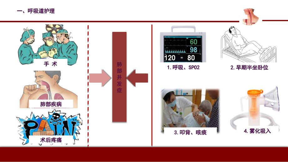 食管癌患者术后护理ppt课件_第4页