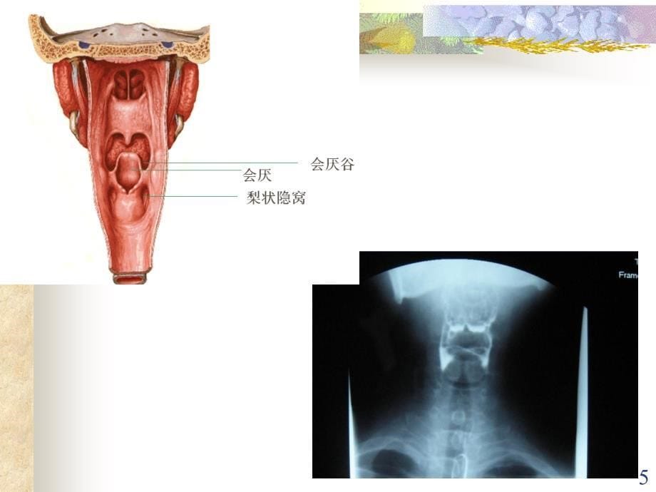 吞咽障碍的评定与康复护理ppt课件_第5页