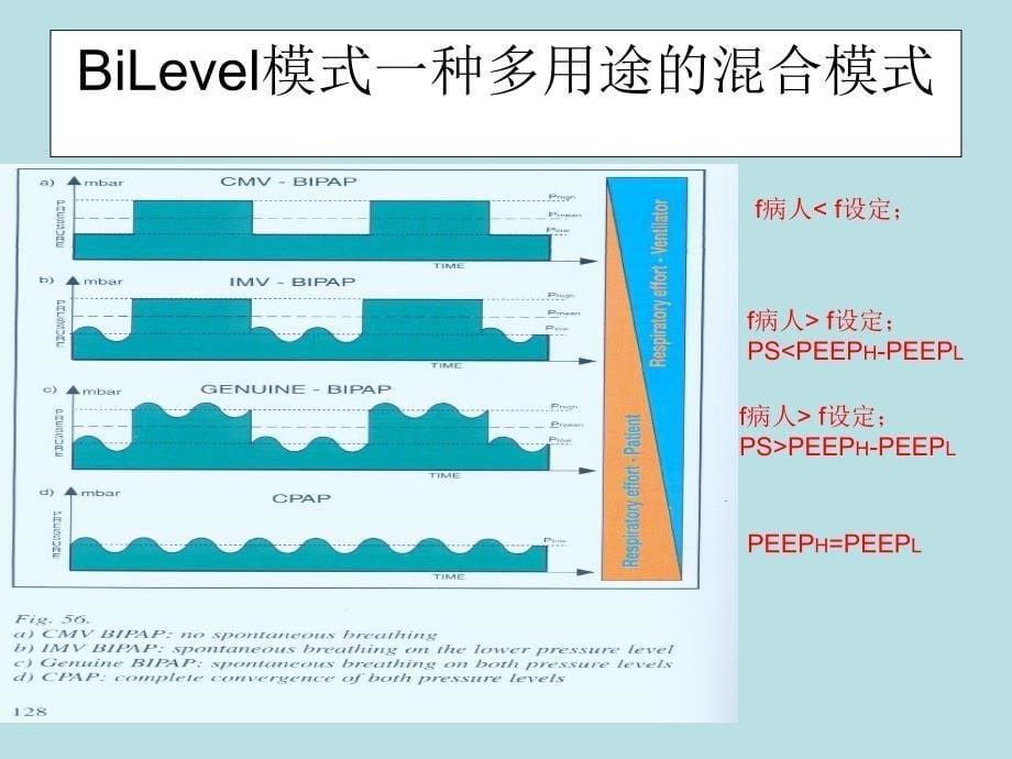 BiLevel双水平通气模式简介_第5页