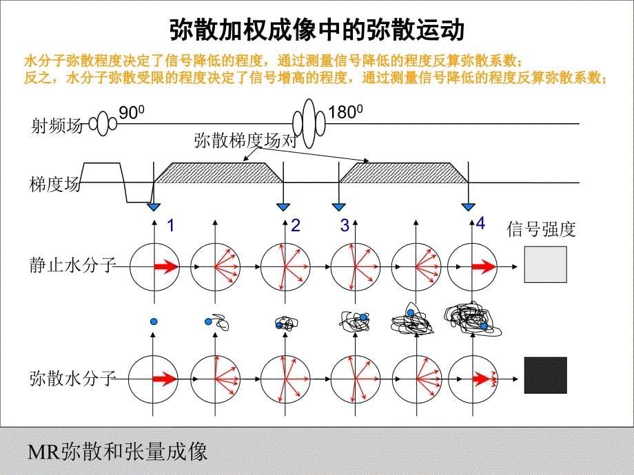 DWIDTI的原理和临床应用课件_第5页