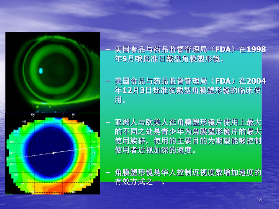 角膜塑形镜知识普及_第4页