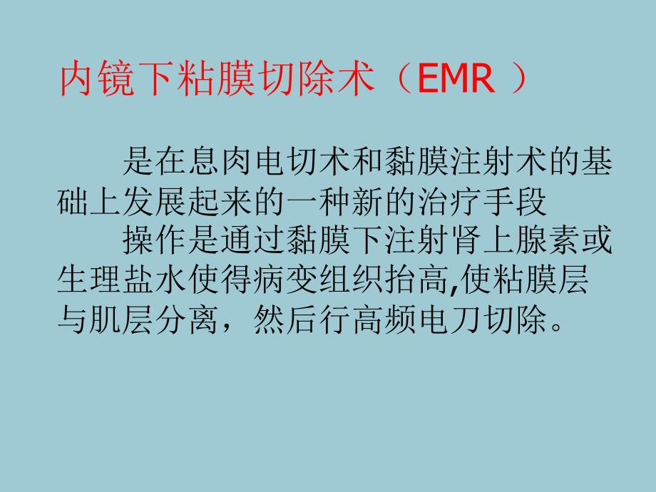 EMR内镜下黏膜切除术_第2页