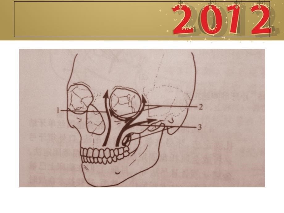 颌骨骨折课件_第5页