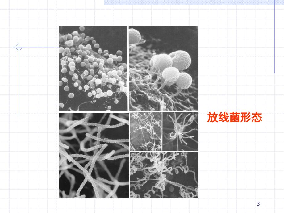 放线菌与诺卡菌 ppt课件_第2页