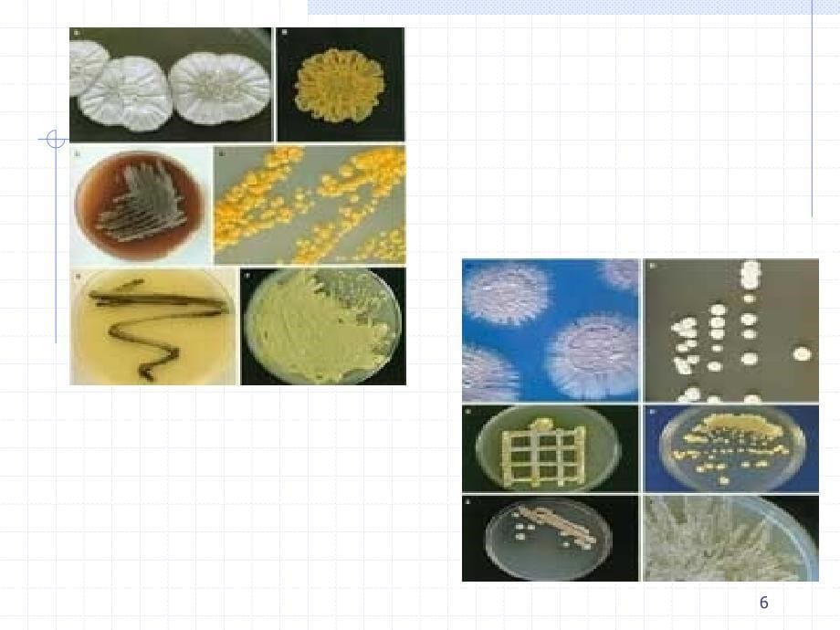 放线菌与诺卡菌 ppt课件_第5页