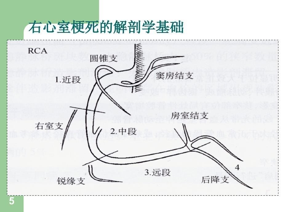 右心室梗死的诊断与治疗_第5页