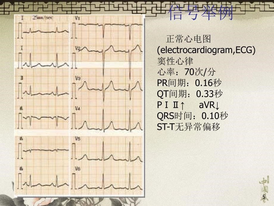 数字信号处理-绪论zxl_第5页