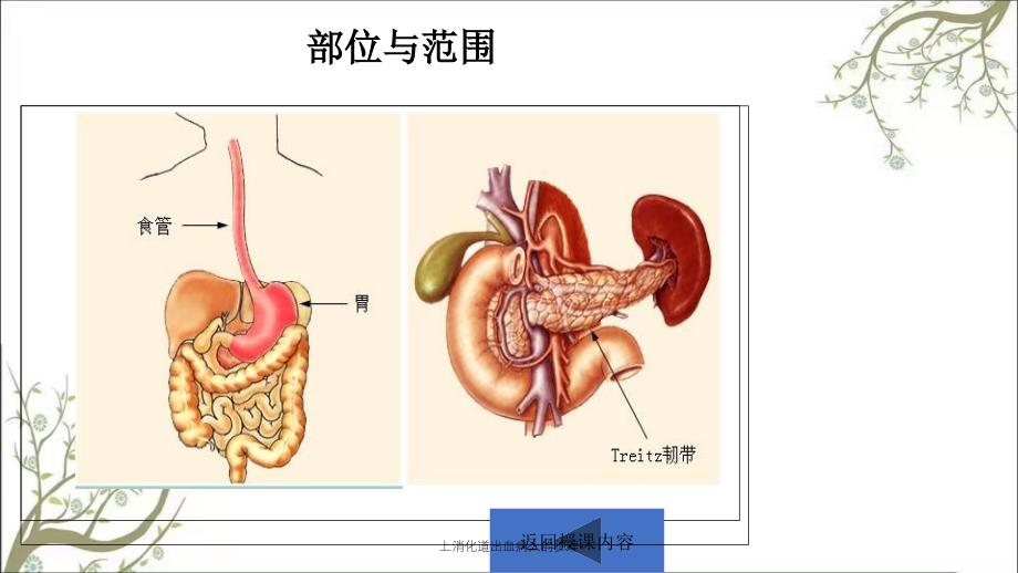 上消化道出血病人的护理课件_第4页