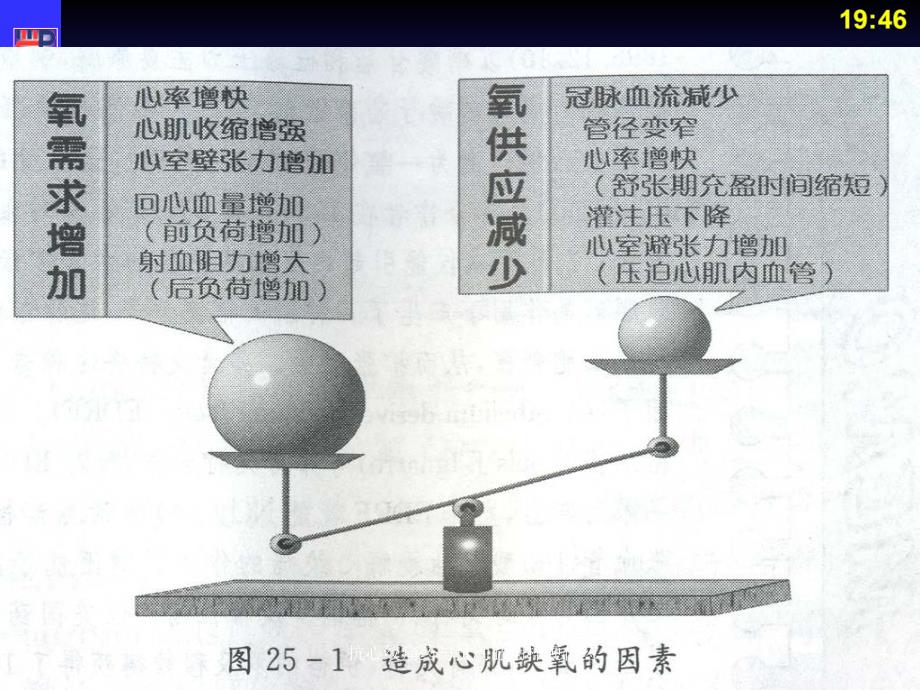 抗心绞痛药与抗动脉粥样硬化药课件_第4页