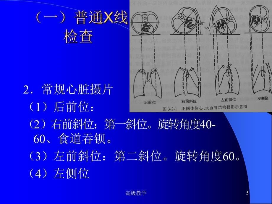 医学超级全 影像学考试重点循环系统临床【特选资料】_第5页