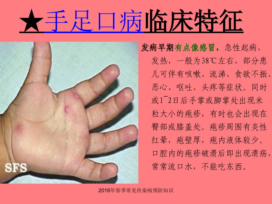 季常见传染病预防知识课件_第4页