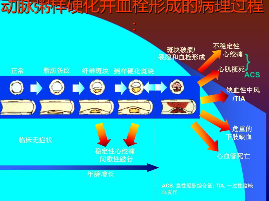 冠心病讲义PPT课件_第4页