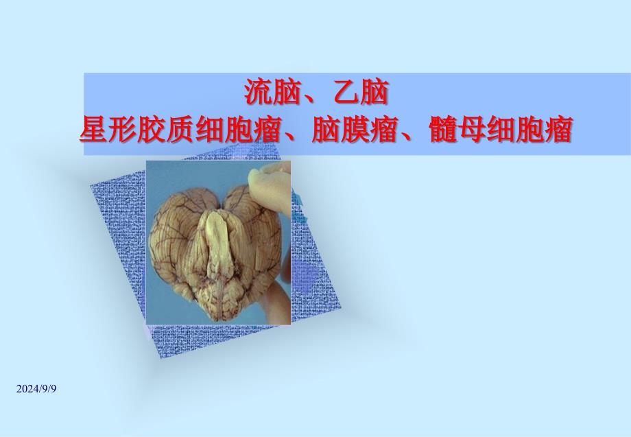 神经系统疾病病理学教研室_第1页