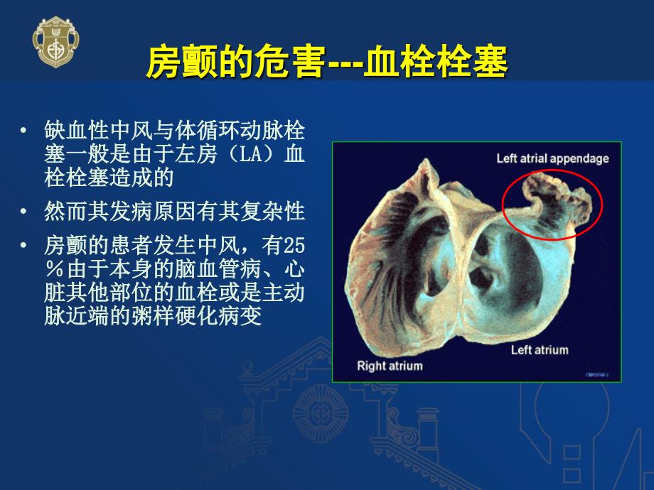 房颤的抗凝治疗课件.ppt_第4页