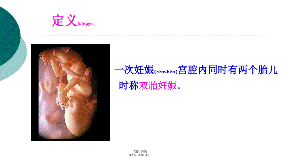 双胎妊娠课件_第2页