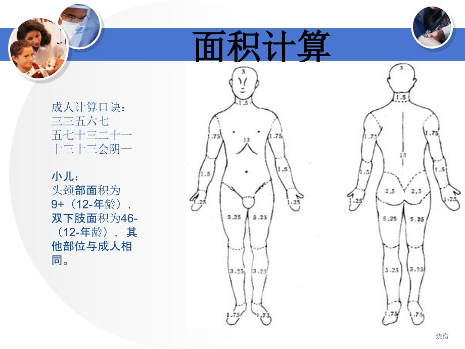 烧伤病人护理查房_第4页