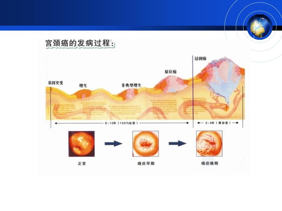 宫颈鳞状上皮细胞增生精选文档_第4页