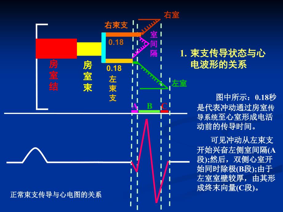 关于束支阻滞特殊心电现象的解析王永权_第3页