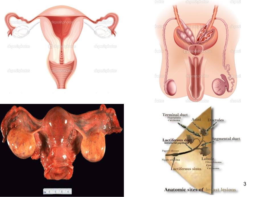 生殖系统疾病 ppt课件_第3页