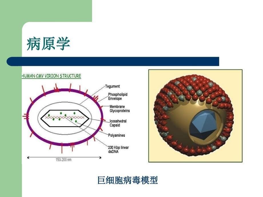 巨细胞病毒感染_第5页