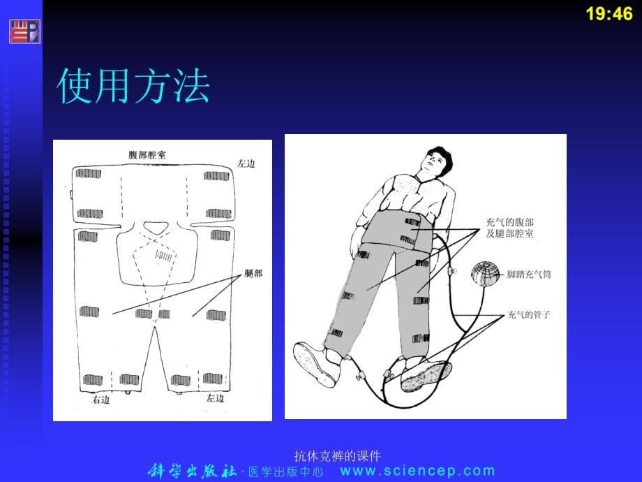 抗休克裤的课件_第5页