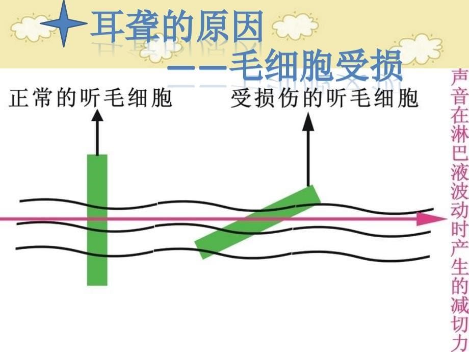 功能性内耳毛细胞与耳聋_第5页