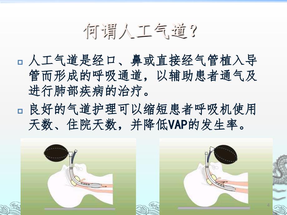 人工气道集束化护理策略课堂PPT_第4页