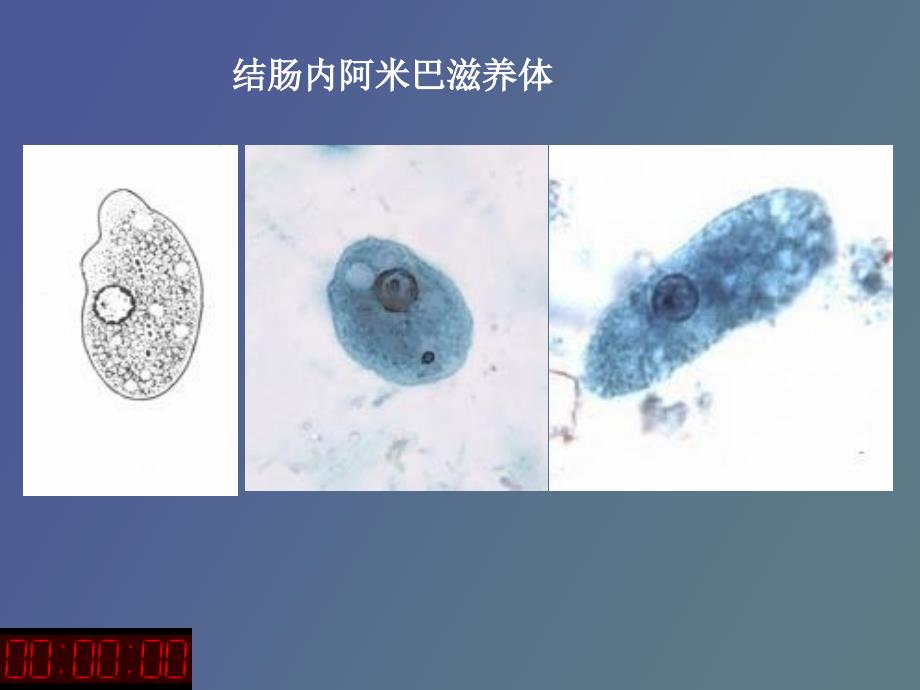 阿米巴原虫鞭毛虫_第4页