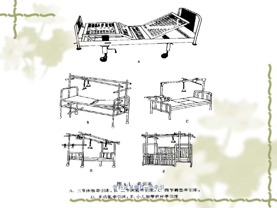 最新骨科常见操作骨牵引_第5页