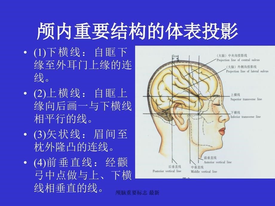 颅脑重要标志最新课件_第5页