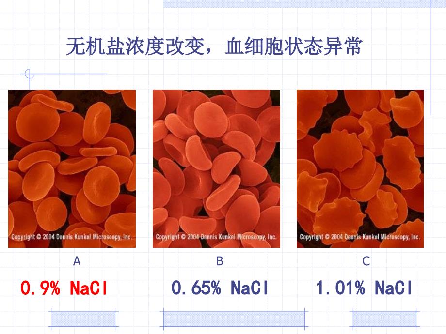 5人体内废物的排出复习_第3页