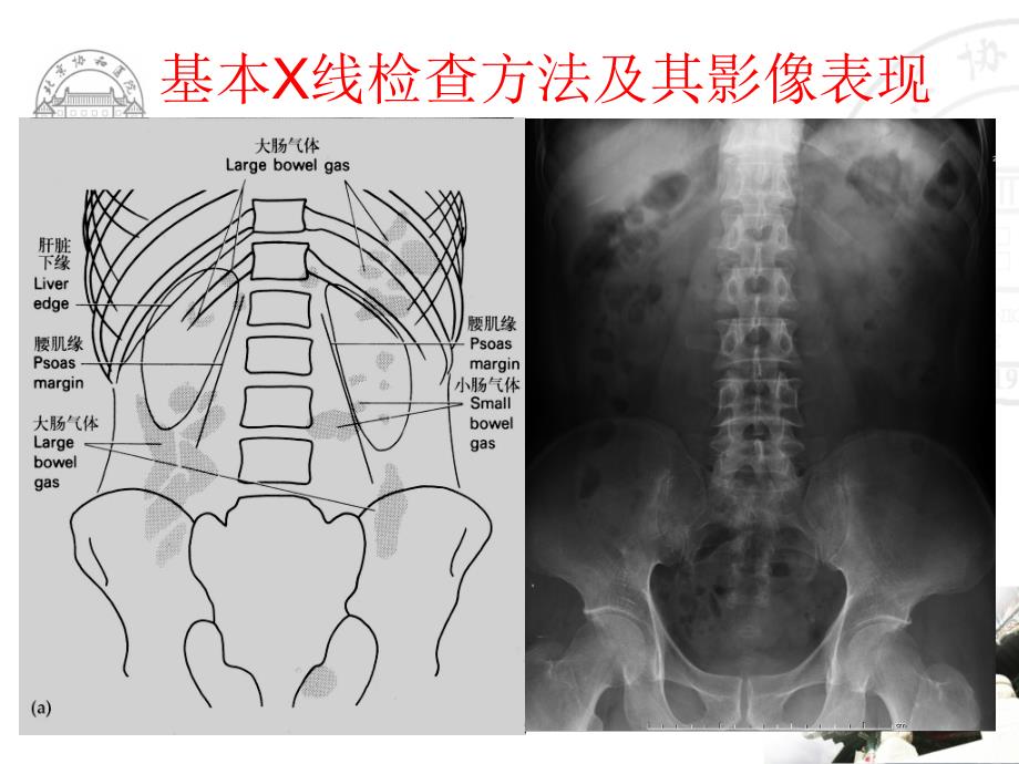 医学影像学课件：泌尿生殖系统正常及异常影像学表现_第2页