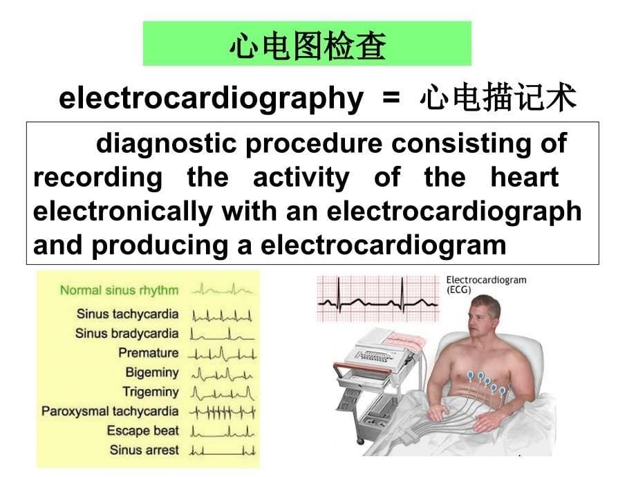 临床心电学基本知识参考PPT_第5页