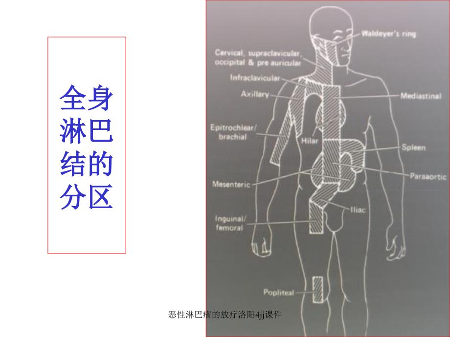 恶性淋巴瘤的放疗洛阳4jj课件_第3页