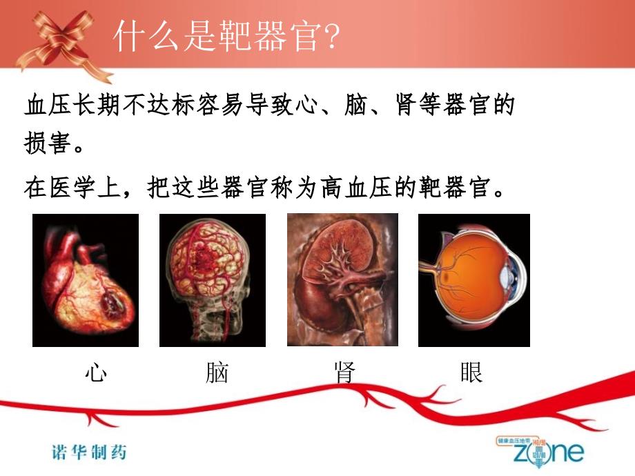 高血压与并发症_第4页