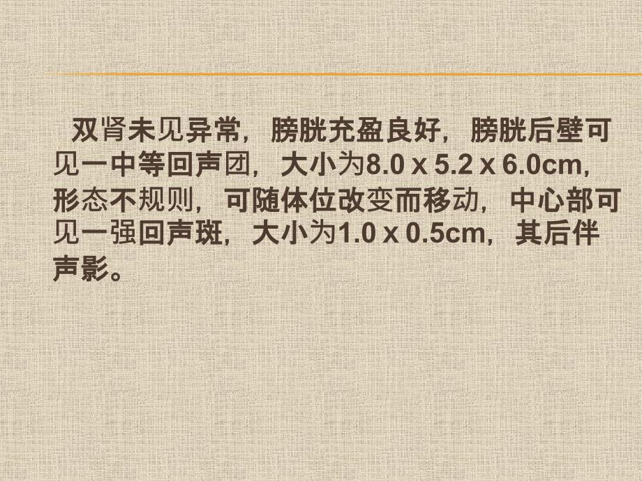 超声病例分析-膀胱.ppt_第4页