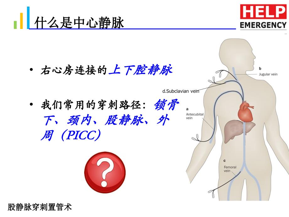 股静脉置管术_第2页