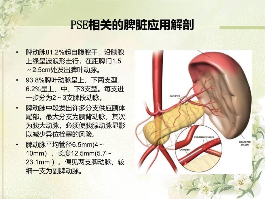 部分脾动脉栓塞术的临床应用_第5页