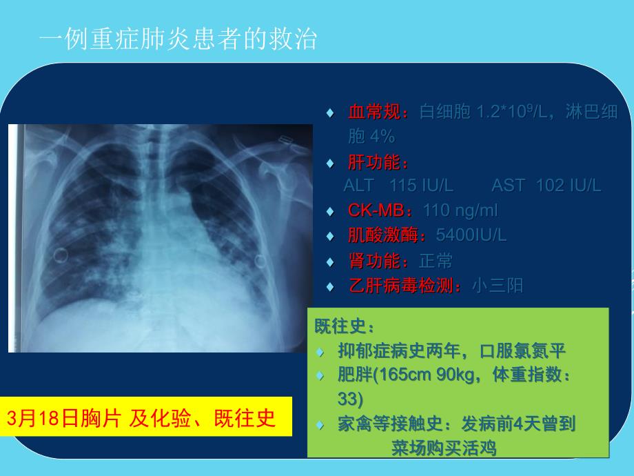 不明原因肺炎学习ppt演示课件_第4页