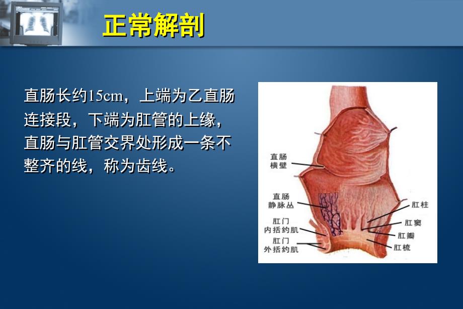 直肠癌术前MR分期课件_第4页