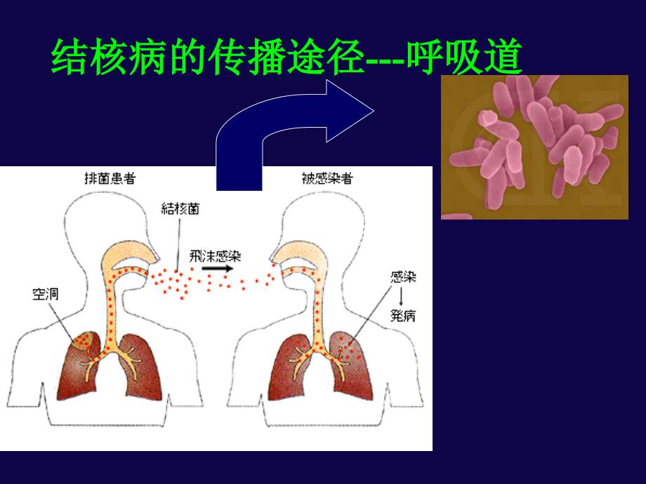 抗结核、抗真菌_第4页