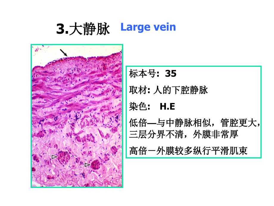 《组织学与胚胎学》实验：实验八 循环系统_第4页